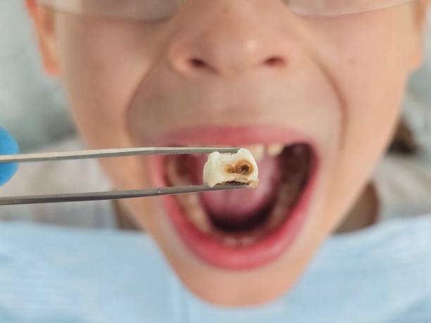 Best Urgent Tooth Repair  in Waipahu, HI